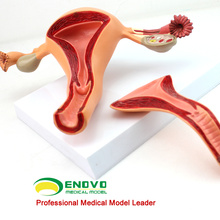 SELL 12442 Uterine Structure Anatomical Model Anatomy Reproductive System